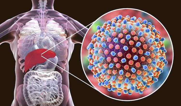 An overview of Hepatitis