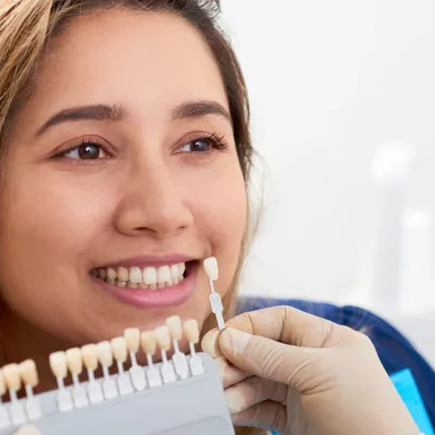 The Role of Porcelain Veneers in Achieving a Red-Carpet Smile